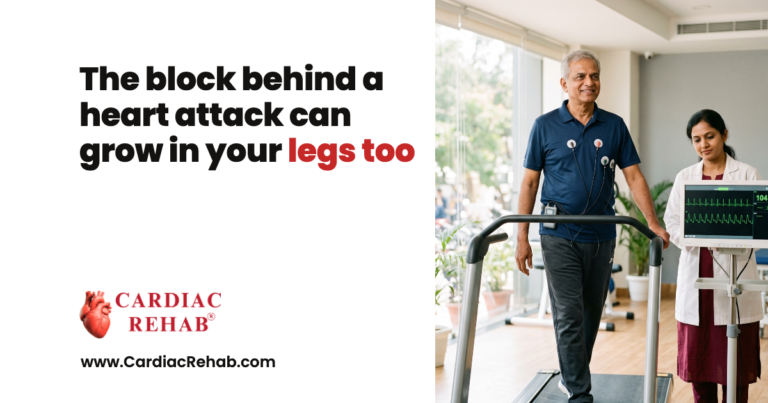 A man walking on a treadmill with heart monitor leads under physician supervision, beside the words the block behind a heart attack can grow in your legs too, and the Cardiac Rehab logo