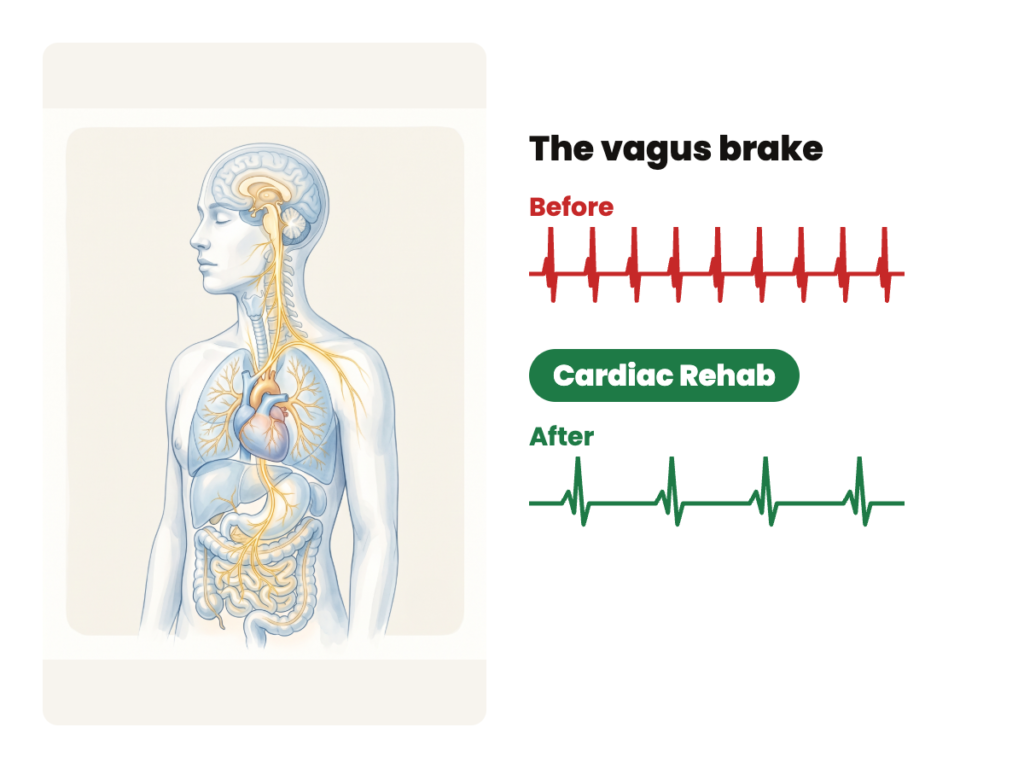 The vagus nerve from brain to heart, lungs and gut. Beside it, a fast red heart line turns slow and green after Cardiac Rehab.